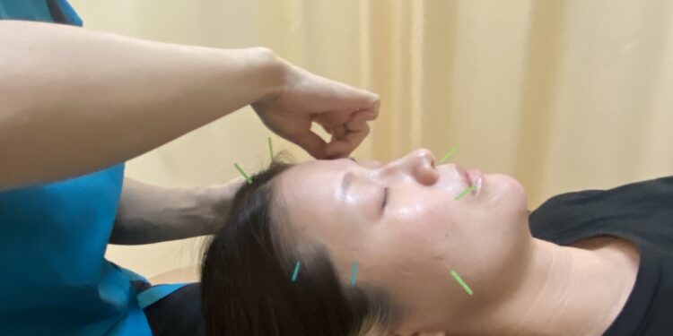 お顔の疲れ取り【筋膜リリース＋美容鍼】で肌質改善😄