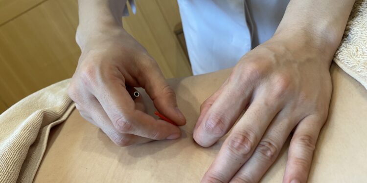 寒い時期の肩こり・腰痛にはお灸がおすすめ