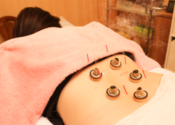 鍼灸施術で陽気を発散　自律神経ケア